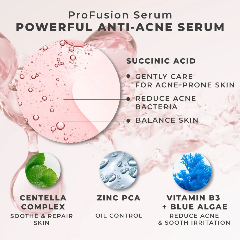 HER HYNESS | CALM ANTI-ACNE BLACK MASK 🩷 Succinic Acid & Centella Complex | 25ml